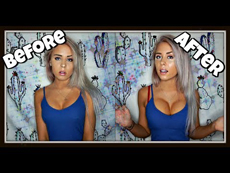 Upbra before and after