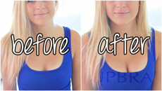 Upbra before and after