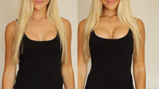 Upbra before and after