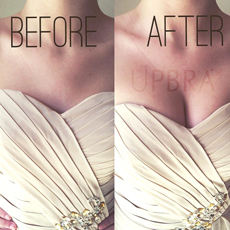 Upbra before and after