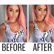 Upbra before and after